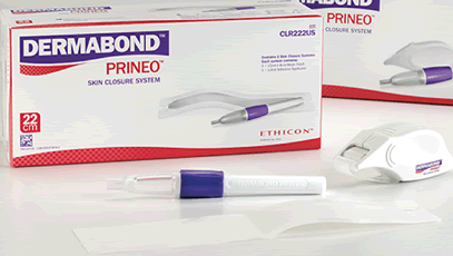 Ethicon DERMABOND PRINEO Skin Closure System (60 cm), CLR602US, Combination  of Self-Adhering Mesh and Topical Skin Adhesive, Medical Supplies